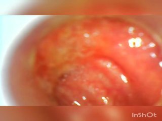 Usb endoscope 80 cm profond anal insertion, cochon vidéo d2